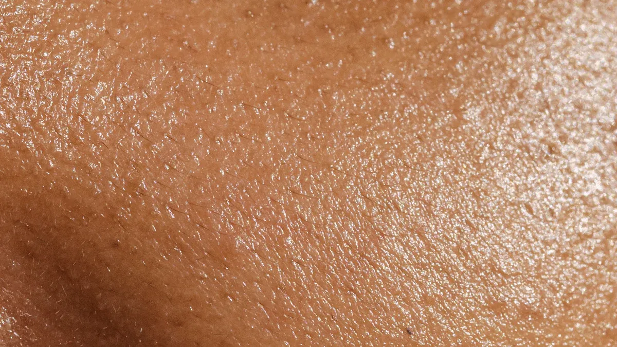 large pores